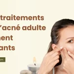 Top 5 traitements pour l’acné adulte vraiment puissants