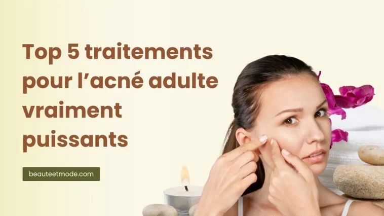 Top 5 traitements pour l’acné adulte vraiment puissants